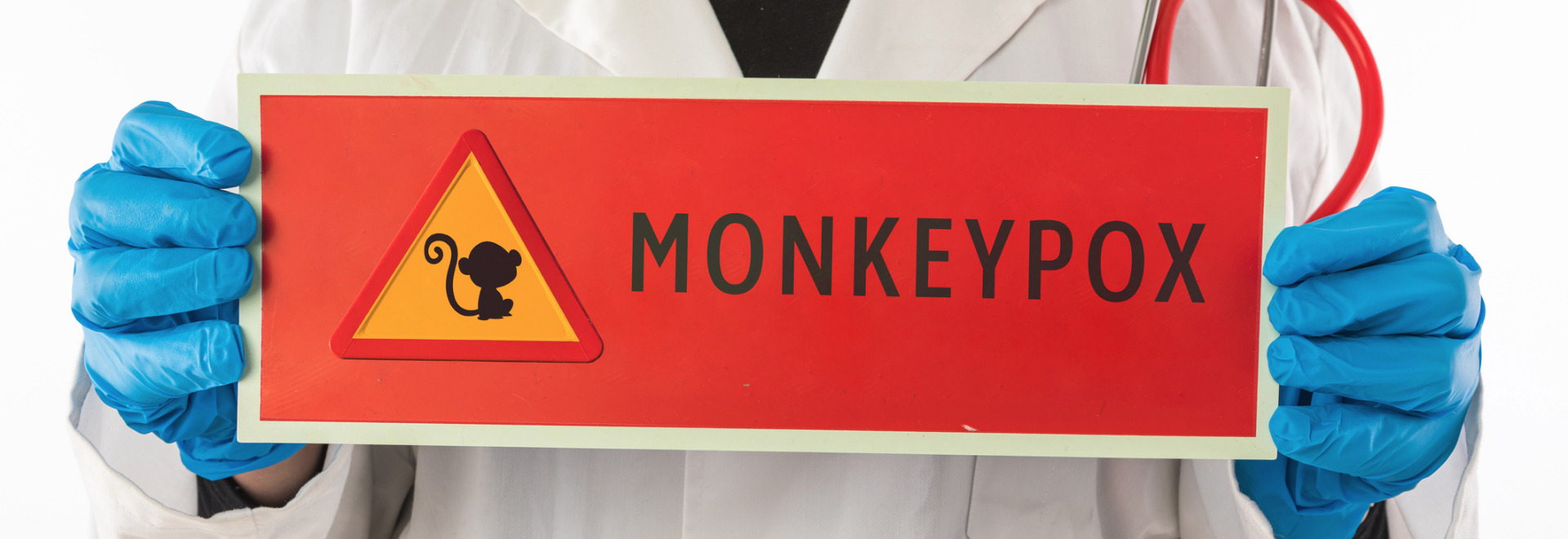 monkeypox-transmission-symptoms-prevention-treatment