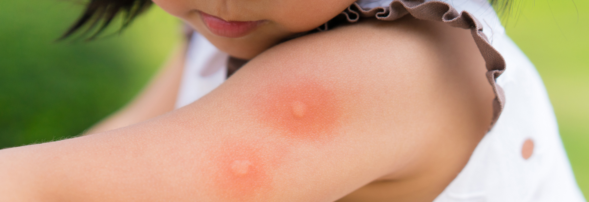 mosquito-repellents-content-things-to-know