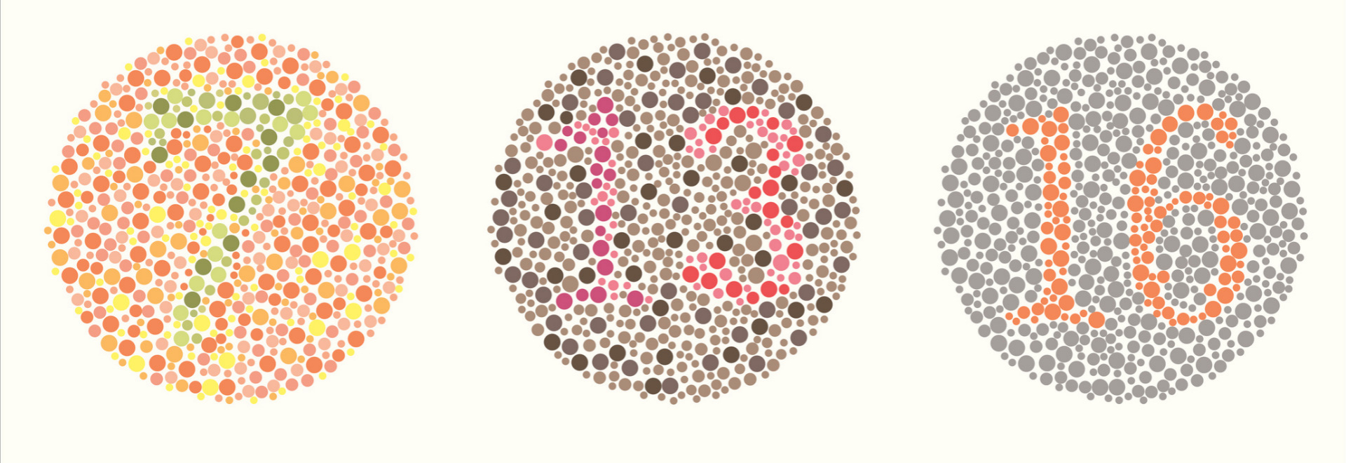 colour-vision-deficiency-causes-symptoms-treatment