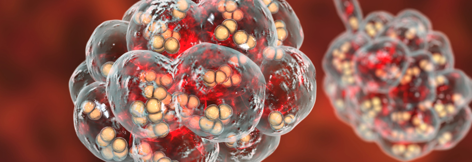 pneumococcal-infection-causes-symptoms-treatment